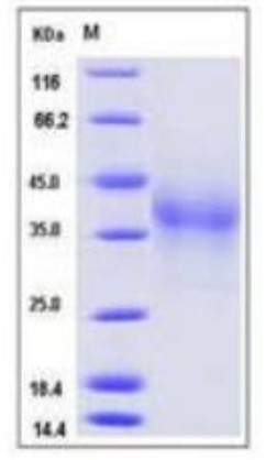 SDS-PAGE (PDCD1-28H).jpg